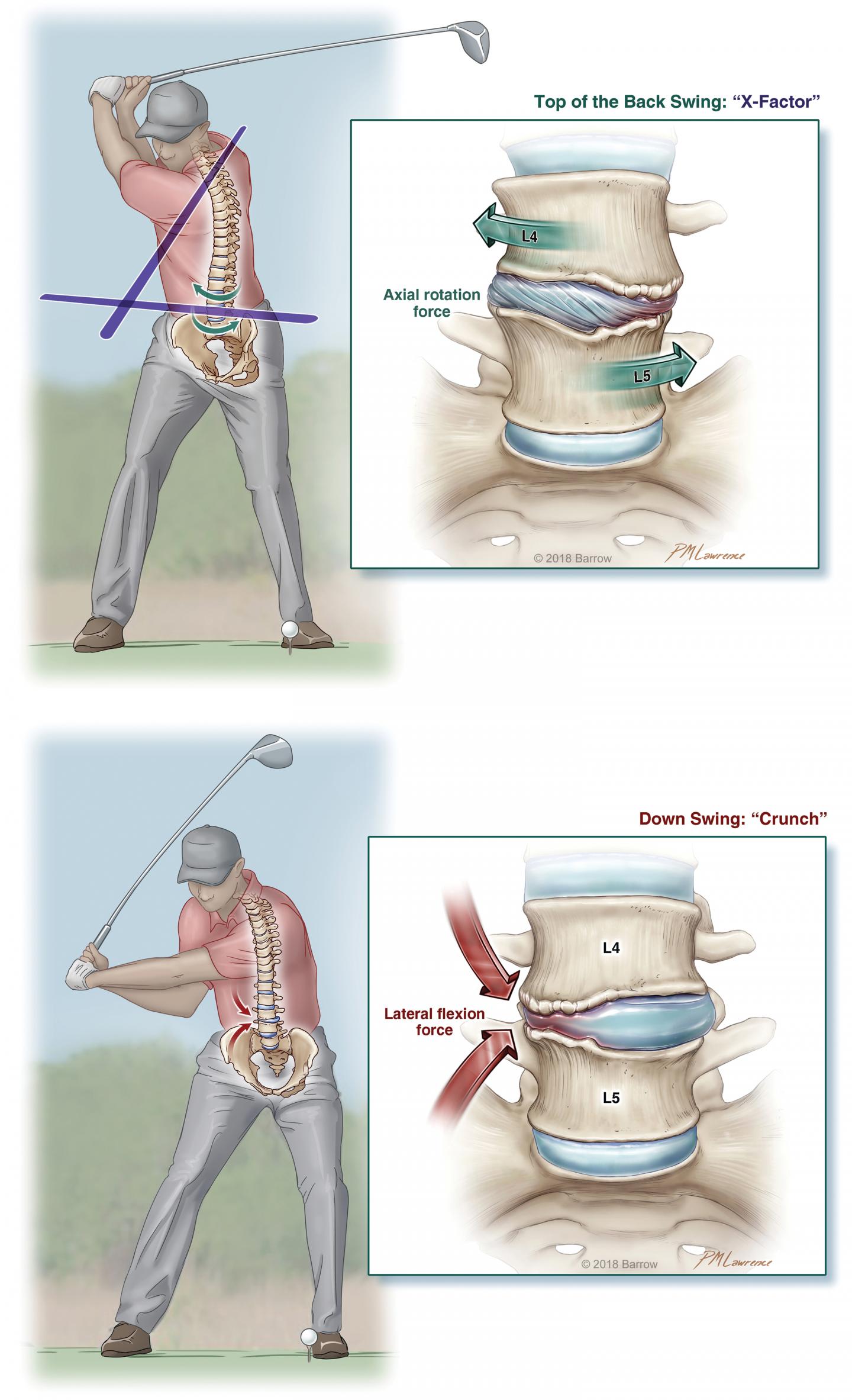 Golf: a Contact Sport