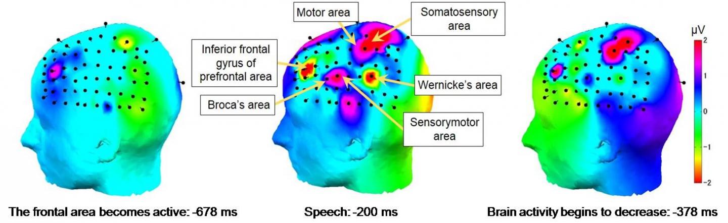 Fig3 脳活動の推移 (8名10音節平均)