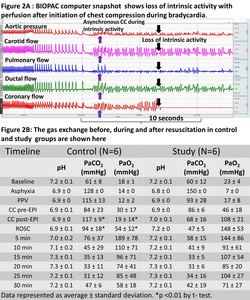 Figure 2A: BIOPAC computer snapshot shows loss of intrinsic activity with perfusion after initiation of chest compression during bradycardia.