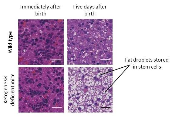 Mice lacking the ketogenesis function develop fatty livers early in life