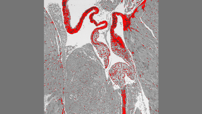 Heart of a mouse that lacks the serotonin transporter (SERT) gene