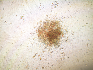 Edited human hematopoietic stem cells