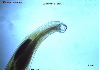 Decoded: DNA of Blood-Sucking Worm that Infects World's Poor