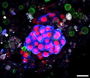 Human kidney organoid-on-chip