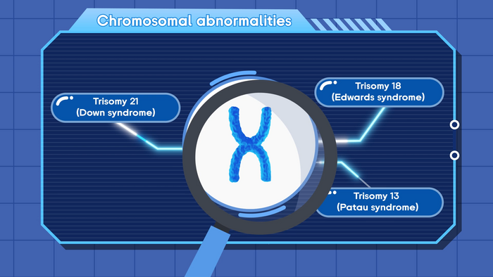 chromosomal abnormalities down syndrome