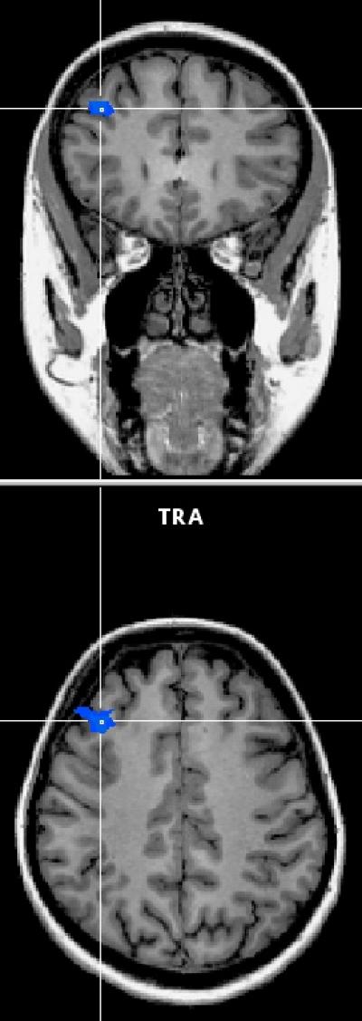 Brain Activity after Self-control Depletion