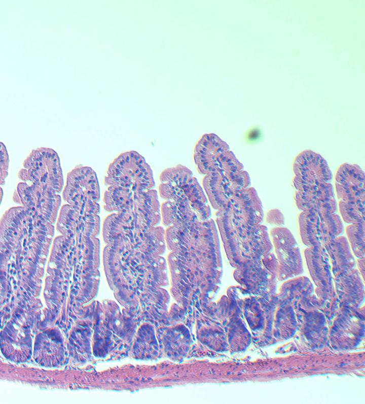 Villi from a Younger Gut