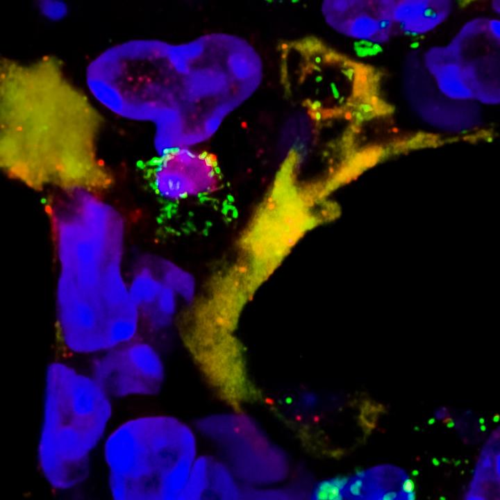 Neutrophil Extracellular Trap