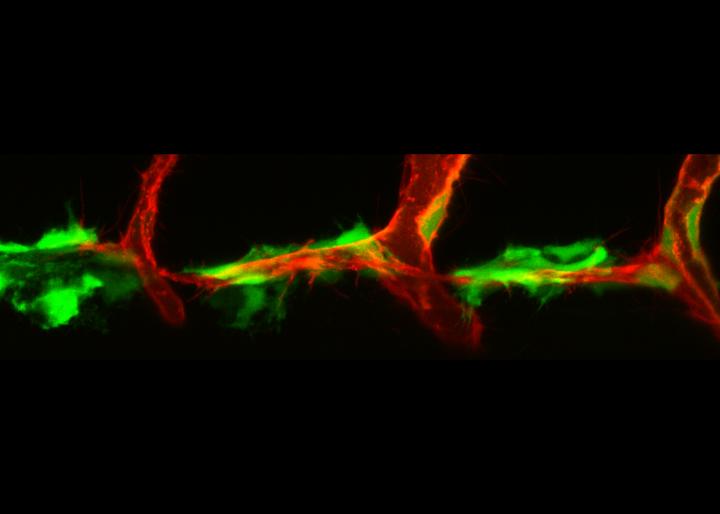 Zebrafish lymphangiogenesis