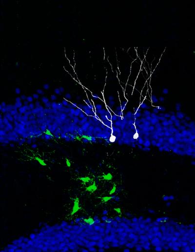 Reprogramming Adult Stem Cells in the Brain