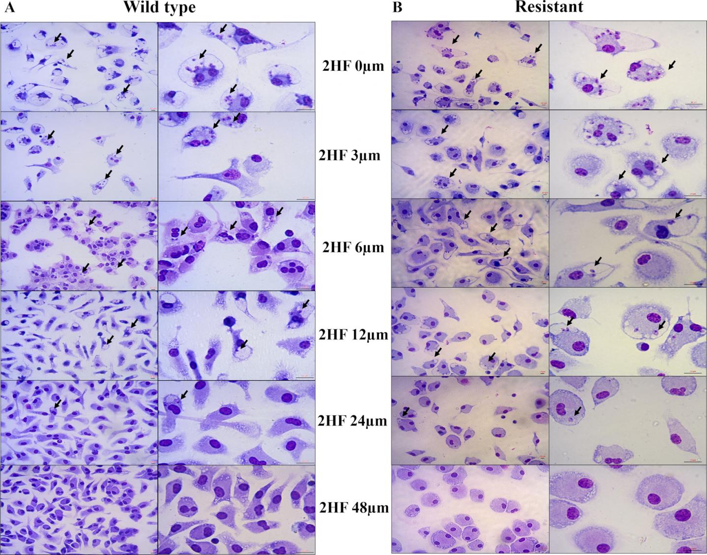 Natural Compound 2HF Treats Leishmaniasis Infections, Study Finds