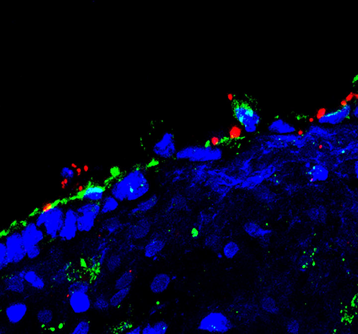 Gonorrhea Bacterium Manipulates an Anti-Infection Mechanism in the Female Reproductive Tract