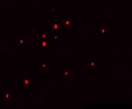 Simple Physical Mechanism for Assembly and Disassembly of Structures inside Cells