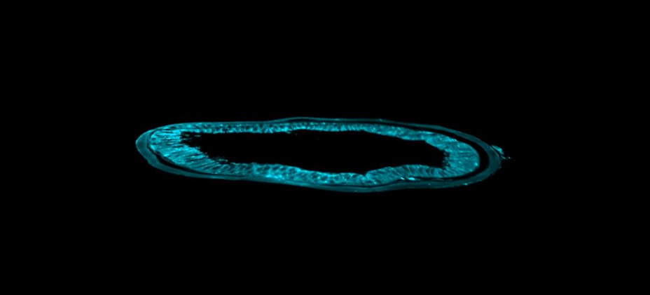 Lightsheet microscope movie of clarified mouse gut in cross-section showing architecture of the colon.