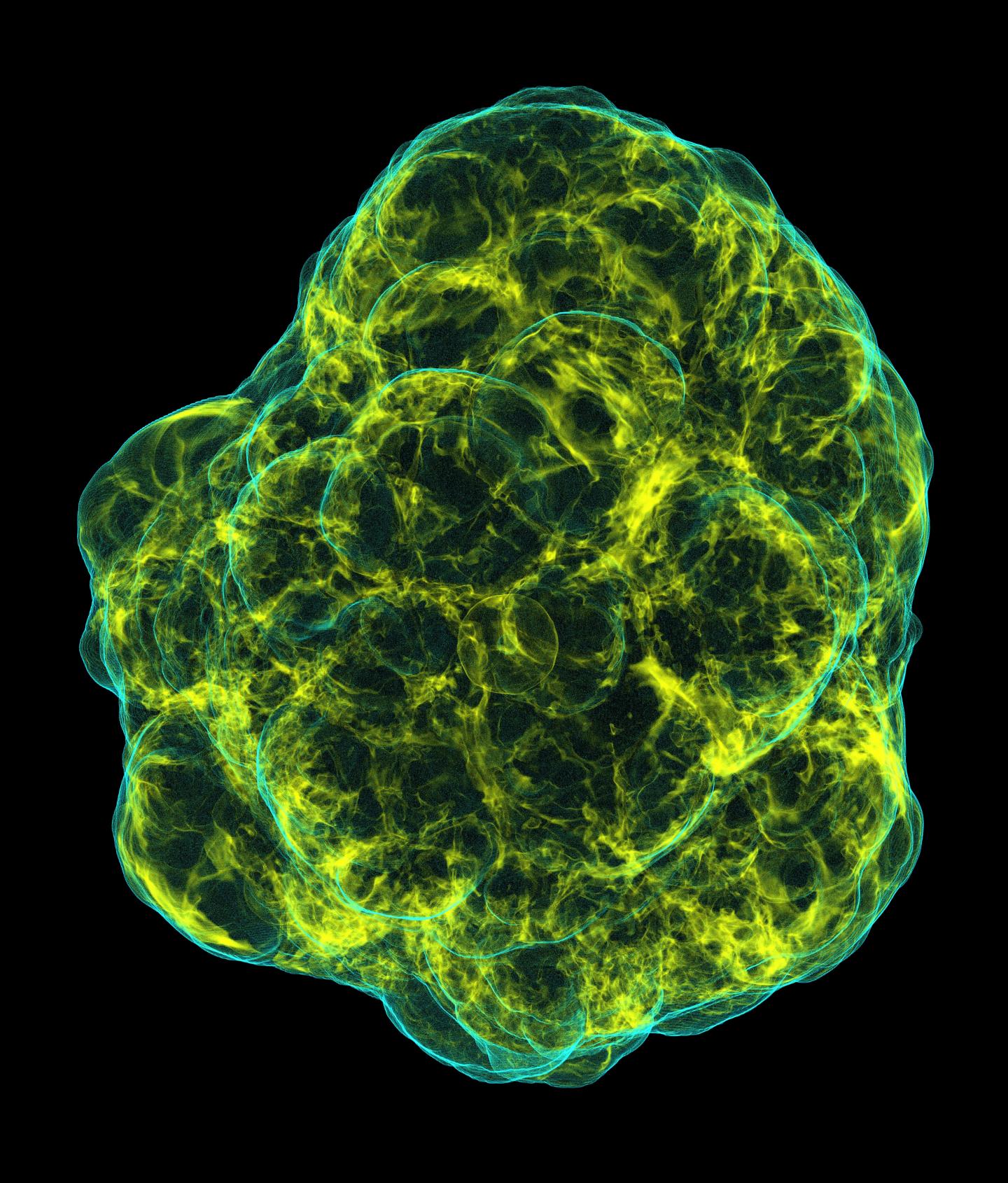 Core-Collapse Supernova