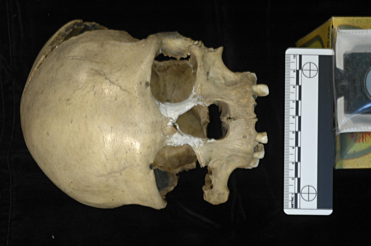 Pestera Muierii Woman's Skull