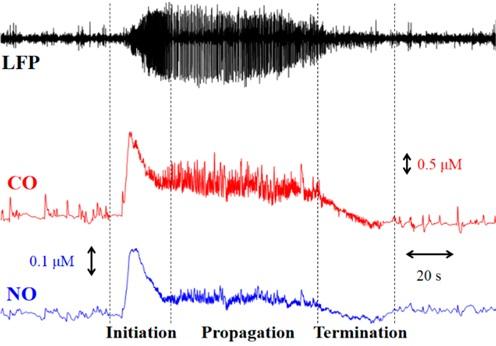 Gas Levels in 3 Phases of Seizure Event