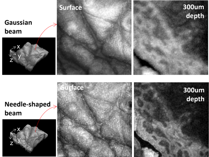 Skin imaging