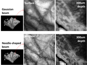 Skin imaging