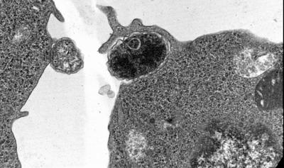 VCU Carlyon Infection Immunity 2012