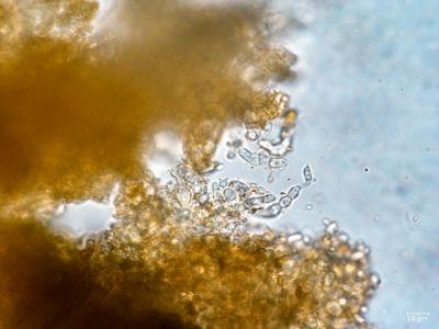 Coniochaeta Pulveracea Cells under the Microscope