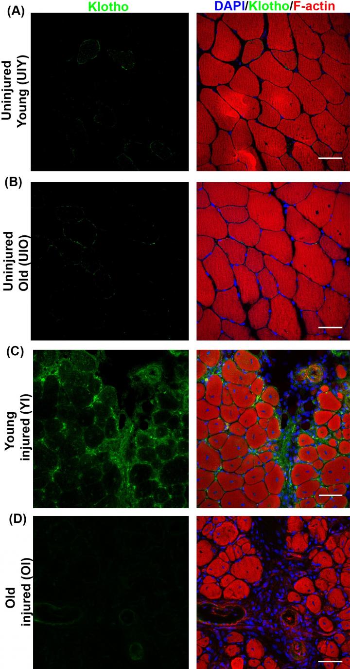 Klotho Clusters Around Young Healing Muscle