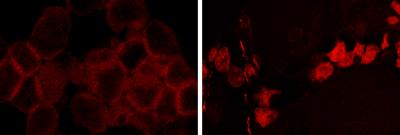 Common Blood Cancer May Be Initiated by Single Mutation in Bone