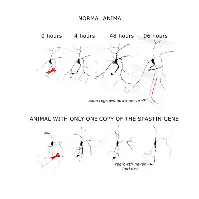 Gene Required for Nerve Regeneration Identified