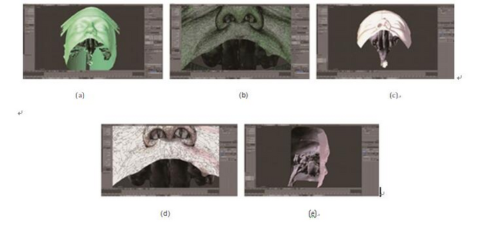 Treatment of three-dimensional mesh file of computed tomography examination