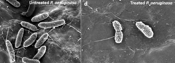 Dendritic hydrogel v. bacteria