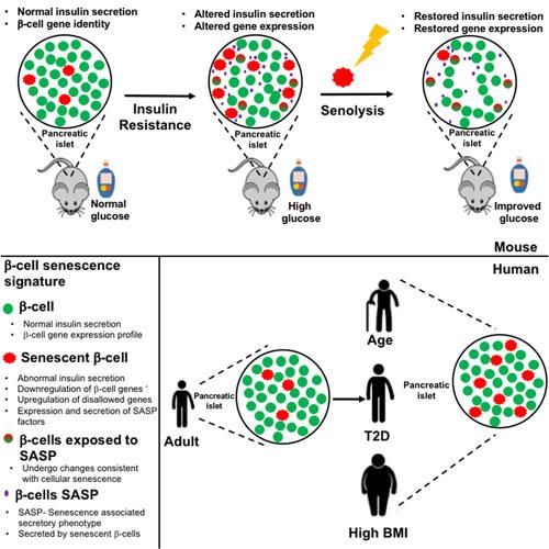 Aging Beta-Cells Determine Diabetes -- Senolysis Restores Function