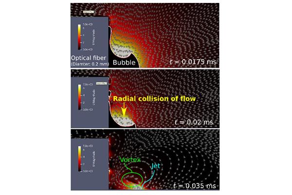 Revealing the Reason Behind Jet Formation at the Tip of Laser Optical Fiber