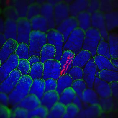 Cells with Mutations Don