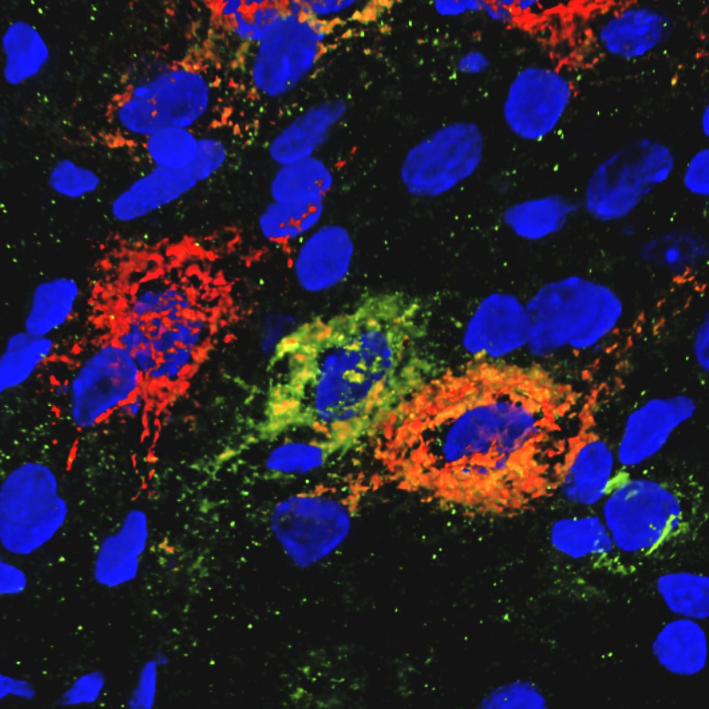 Extracellular perineuronal net matrices enmesh neurons