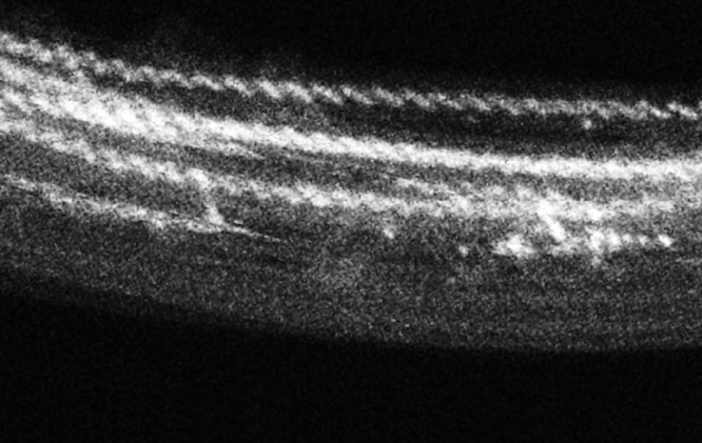 TEM of Atomic Chains