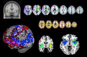 Brain Area Thought to Impart Consciousness, Behaves Instead Like an Internet Router