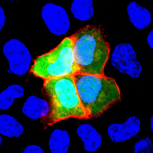 Cell-based assay to detect the anti-NCAM1 autoantibody