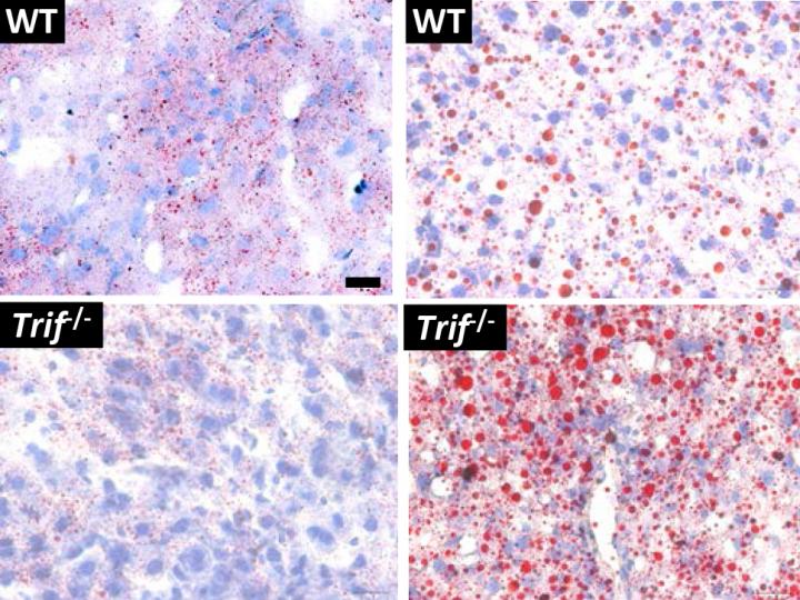 Antiviral Defense Against Hepatic Steatosis (1 of 2)