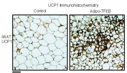 A Protective Factor Shields Mice from Obesity and Metabolic Disease (1 of 1)