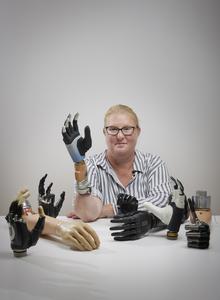 A highly integrated bionic hand in between many others