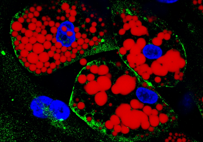 Visceral fat and COVID-19