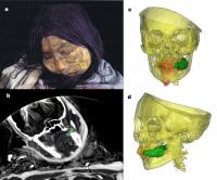 CT Scan of Old Inca Girl