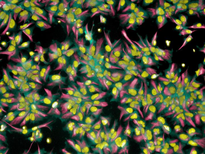 Neural Stem Cells