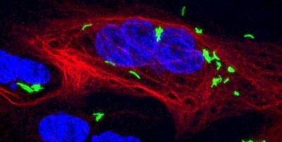 M. tuberculosis-infected Qhite Blood Cell