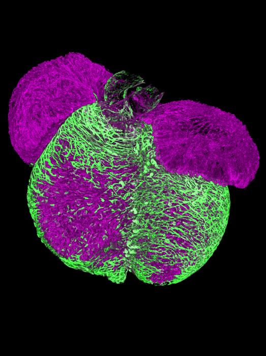 Embryonic mouse heart