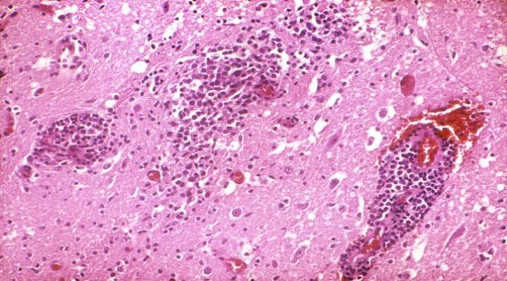 A Single Mutation May Impact Infectivity of West Nile and Similar Viruses