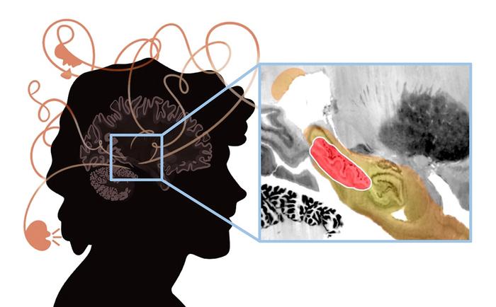 Mapping Lesions That Cause Psychosis to a Human Brain Circuit and Proposed Stimulation Target