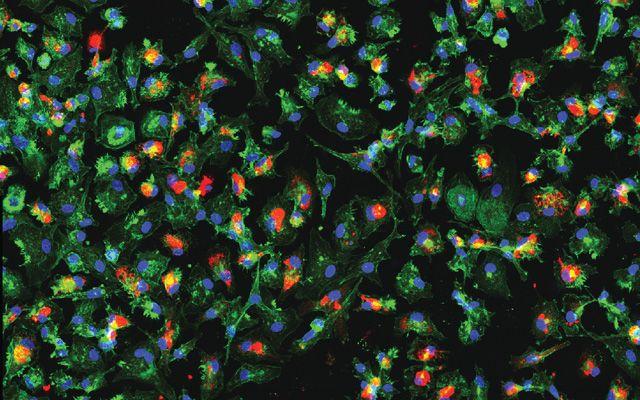 Human Macrophages and Zika, UC San Diego Health