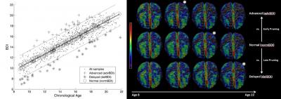 New Penn Index Detects Early Signs of Deviation from Normal Brain Development