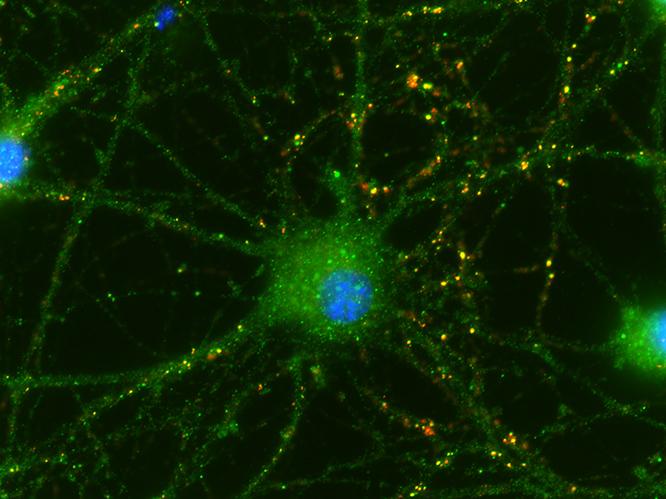 Cells Isolated from Newborns' Umbilical Cords